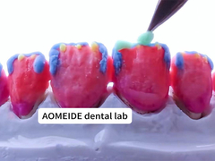 ความแข็งแรง ความสวยงามธรรมชาติ มงกุฎซิกอร์โคนยาที่แข็งแรง เหมาะสําหรับฟันเดียวหรือฟันหลายฟัน