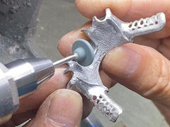 ฟันเทียมบางส่วน