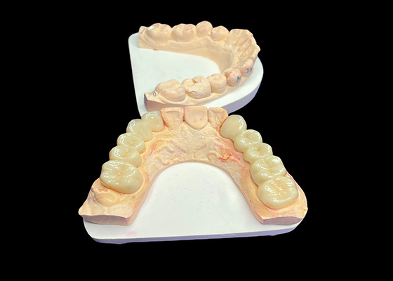 ซื้อ สวยงามทางธรรมชาติ ราชกุฎเซรามิกโปร่งใสสําหรับการฟันฟัน online manufacture