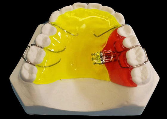 ซื้อ อุปกรณ์ Orthodontic ถอนออก 3 ทิศทาง สําหรับความต้องการของลูกค้าในราคาที่แข่งขัน online manufacture