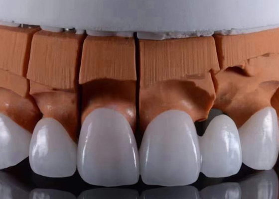 ซื้อ FDA อนุมัติมงกุฎฟันสี Zirconia ใส เหมาะสมกับลักษณะธรรมชาติ online manufacture