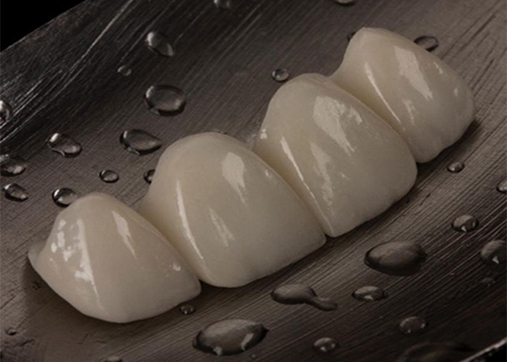 ซื้อ สะพานมงกุฎเซรามิกที่สามารถปรับแต่งได้ สําหรับฟันที่หายไป สะดวกสบาย online manufacture
