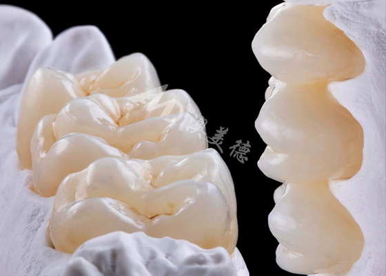 ซื้อ รางวัลฟันซิกโคนยาความแข็งแรงสูง สําหรับการเปลี่ยนฟันเดียวหรือหลายฟัน online manufacture