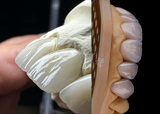 ซื้อ ยาวนานฟันแข็ง Zirconia ราชสีมา ฟันราชสีมาเหมาะสม Zirconia ห้องปฏิบัติการฟัน online manufacture