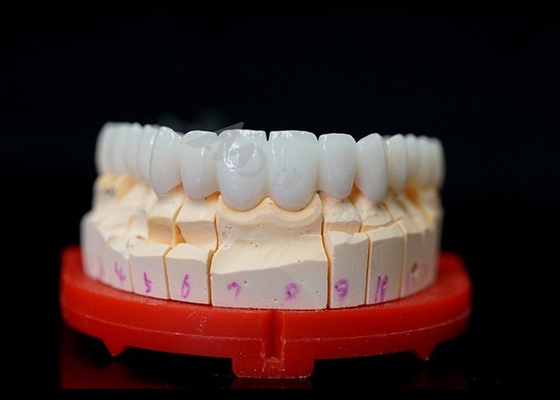 ซื้อ ราชกุฎซิกอร์โคนิยมที่เหมาะสมอย่างแม่นยํา online manufacture