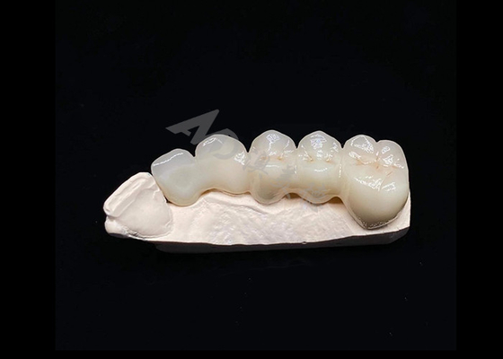 ซื้อ ภาพโปร่งใส สวยงามตามธรรมชาติ มงคลซิลคอนเนียแข็ง สําหรับฟัน ทนต่อการแตก online manufacture