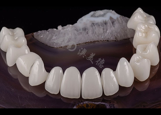ซื้อ ฟันโปร่ง ซิลิด ซิรคอนิยา โครงธรรมชาติ สวยงาม ทนต่อการฉีก online manufacture