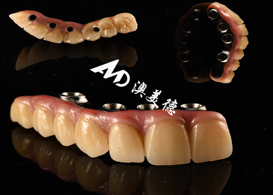 ซื้อ ปลูกฟันที่ดูธรรมชาติ สะพานมงกุฎ ติดตั้งด้วยทิตาเนียมสําหรับการผ่าตัดฟันที่หายไป online manufacture