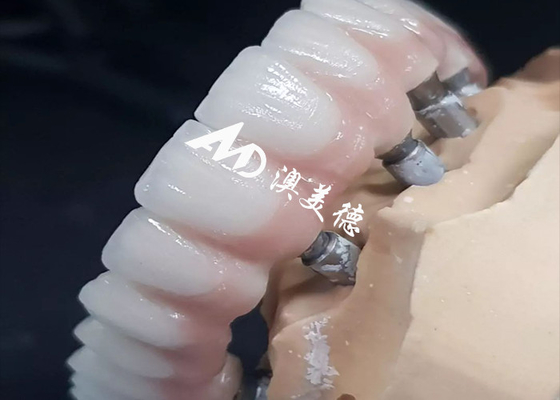 ซื้อ อุปกรณ์ประกอบฟันประสิทธิภาพสูงพิเศษ สะพานมงกุฎ มีหลายขนาด online manufacture