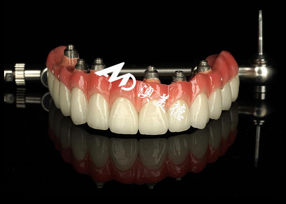 ซื้อ ปลูกฟันตามต้องการ ปลูกฟันที่สนับสนุนโดยการปลูกฟัน Crown Bridge สําหรับการบํารุงรักษาฟันที่ขาด online manufacture