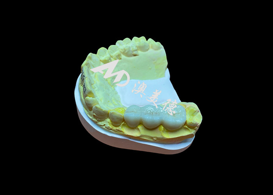 ซื้อ พื้นผิวเรียบตามความต้องการ Zirconia รางวัลฟัน Biocompatibility สูง ทนต่อคราบ online manufacture