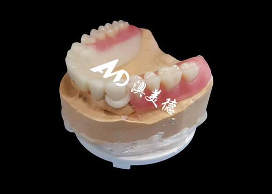 ซื้อ โปรโมชั่น Hpp Frame Acrylic Removable Partial Denture สําหรับฟันที่หายไป online manufacture