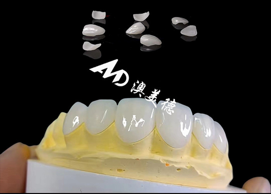 ซื้อ Translucency IPS Emax Veneers การเตรียมความพร้อมขั้นต่ํา Emax ฟันฟัน online manufacture