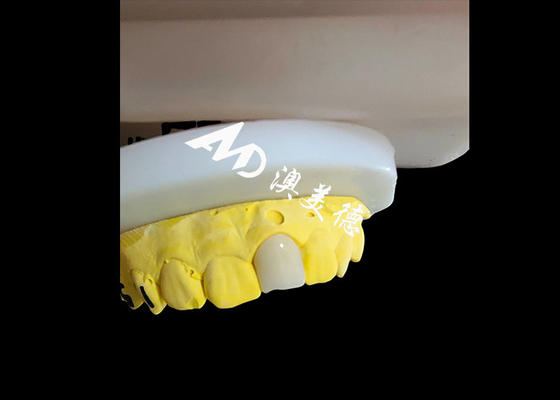 ซื้อ ดูธรรมชาติ อีสเทติก Zirconia รางวัลฟัน ฟันฟันฟันฟันฟันฟันฟันฟัน online manufacture