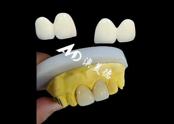 ซื้อ Custom Zirconia ทันตแพทย์มงกุฎ ติดขีดฟันแม่นยําจากห้องปฏิบัติการฟันของจีน online manufacture
