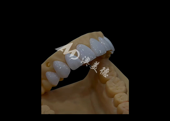 ซื้อ โปรเทสติกทันตแพทย์ Zirconia รางวัลทันตแพทย์ สวยสมบูรณ์อย่างแม่นยํา online manufacture