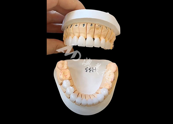 ซื้อ เสริมกระจายแสง Zirconia ราชกุฎฟันสําหรับการฟื้นฟูคงที่หน่วยเดียว / หลายหน่วย online manufacture