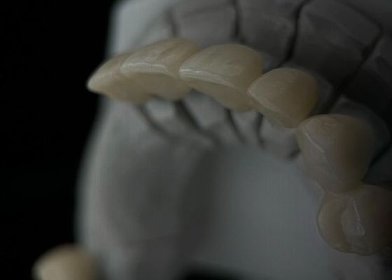 ซื้อ ฟิตมโนลิทิก Zirconia รางวัลฟันด้วยความโปร่งและความทนทาน online manufacture