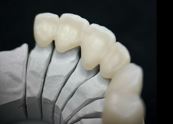 ซื้อ ฟันแข็ง Zirconia ราชกุฎ Ombining ความแข็งแรงที่โดดเด่นและความสวยงามธรรมชาติ online manufacture