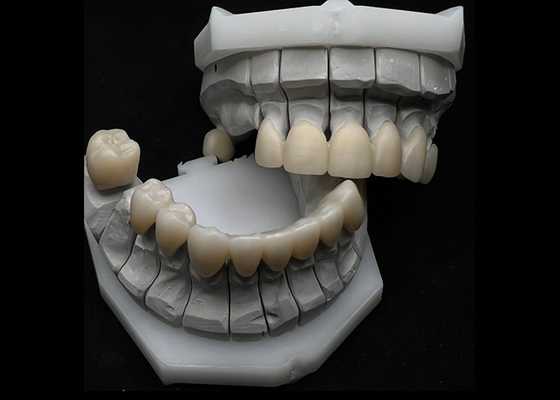 ซื้อ ความต้านทานการฉีกฟัน Zirconia Crown สําหรับฟันเดียวหรือหลายฟัน online manufacture