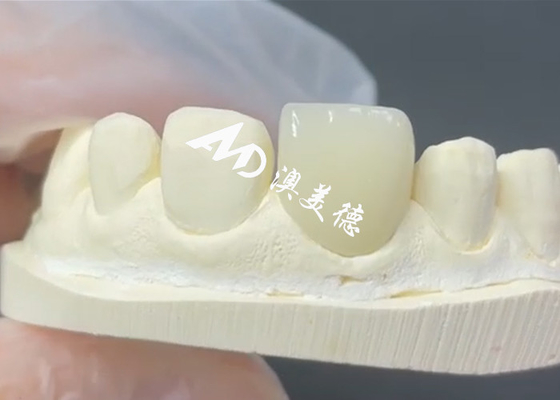 ซื้อ ผง EMAX ที่ทนทานและสวยงาม เป็นทางแก้ไขที่สมบูรณ์แบบสําหรับการซ่อมแซมโพรเซลน online manufacture
