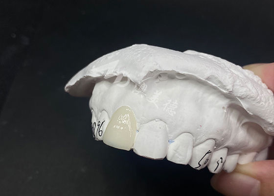 ราคาดี ผงฟันแบบดัดแปลงแบบแพร่กระจาย รวดเร็วและมีประสิทธิภาพ ออนไลน์