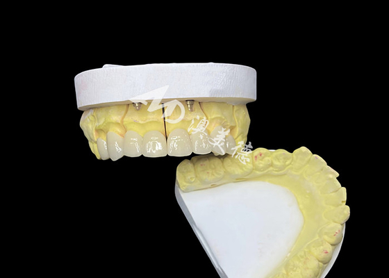 ซื้อ สร้างรอยยิ้มที่สมบูรณ์แบบ ด้วยมงกุฎฟันเซรามิกที่มีคุณภาพสูง เพื่อให้มีลักษณะธรรมชาติและแข็งแรง online manufacture