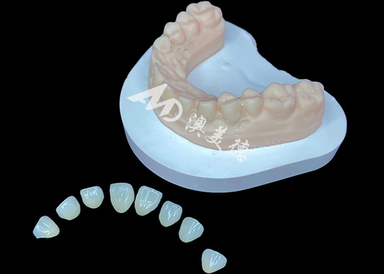 ซื้อ IPS e.max Veneer Premium Aesthetic Solution สําหรับการเปลี่ยนรอยยิ้มที่น่าทึ่ง online manufacture