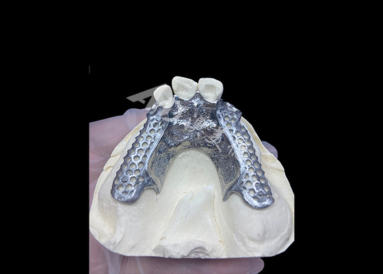 ซื้อ สะดวกสบาย Custom Cast Partial Denture โครงสร้างที่มั่นคงและดูธรรมชาติสําหรับผลการผลิตอย่างรวดเร็ว online manufacture