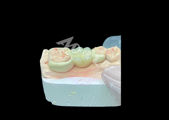 ซื้อ ราชกุฎซิรคอนิยาที่มีสะพานผูก HPP เพื่อเสริมความสวยงามและความเข้ากันได้ทางชีวภาพของรอยยิ้ม online manufacture