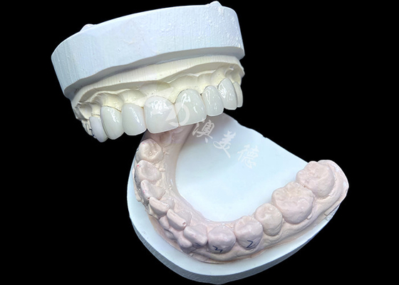 ซื้อ IPS e.max Veneers in Shade BL2 ประสบความงดงามทางธรรมชาติที่น่าทึ่งด้วย 8 หน่วยที่ทําอย่างสมบูรณ์แบบ online manufacture