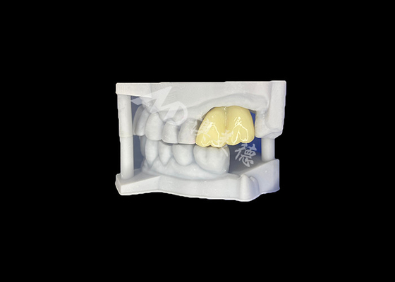 ซื้อ รางวัลฟันซิกอร์คอนเนียแข็ง ความทนทานยาวนาน รับประกัน Molar จากห้องปฏิบัติการฟันจีน online manufacture