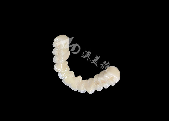 ซื้อ การผูกพันที่ยาวนาน PFM สะพานมงคลฟันที่มีความเข้ากันได้อย่างดีเยี่ยม การผูกพันที่ปลอดภัย online manufacture