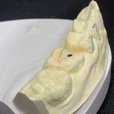 ซื้อ เสริมความแข็งแกร่งในการบูรณะด้วยเทคโนโลยีแกนโพสต์สีชมพู Lock Pink online manufacture