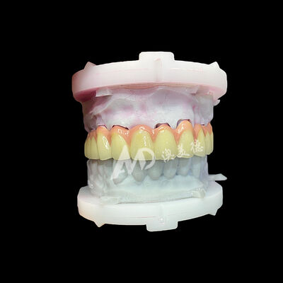 ซื้อ มงกุฎและสะพานเซรามิกไทเทเนียมบริสุทธิ์ ทนทาน น้ําหนักเบา online manufacture