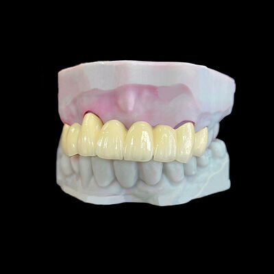 ซื้อ โปรเซลีนหลอมกับโลหะ (PFM) พระราชกุศลที่มีกรอบ Co-Cr online manufacture