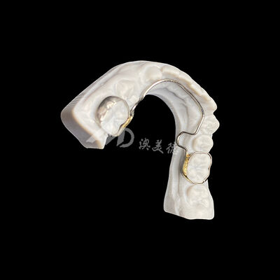 ซื้อ อุปกรณ์จัดฟันแบบ Lingual Arch พร้อมแถบรัดเพื่อการบำรุงรักษาพื้นที่และการจัดตำแหน่งทันตกรรม online manufacture