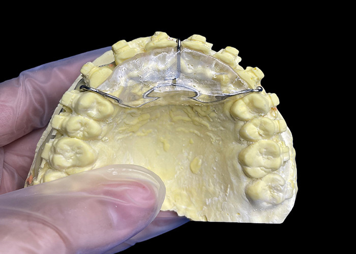 อุปกรณ์ Orthodontic ที่ทําตามสั่ง เพื่อแก้ไขปัญหาการกัด หรือใน TMJ ช่วยลดความกดดันบนข้อคาน