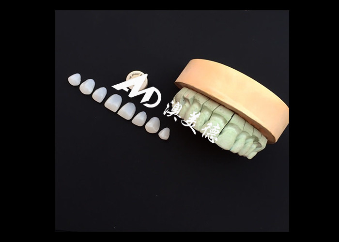 เปลี่ยนแปลงรอยยิ้มของคุณด้วย IPS emax Press Porcelain Veneers ความแข็งแรง ความสวยงามและความทนทานรวมกัน