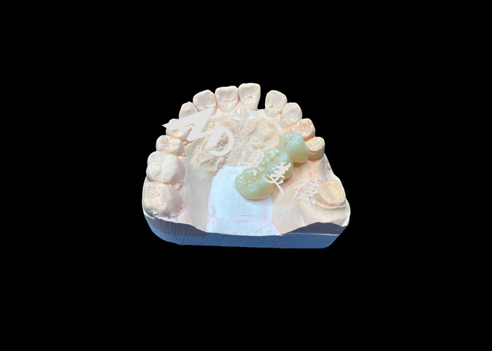 สีธรรมชาติ Zirconia รางวัลฟันทนทานกับรอยแตก สําหรับรอยยิ้มที่บริสุทธิ์จากห้องปฏิบัติการฟันจีน