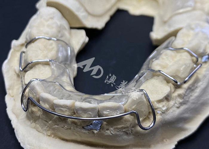 สะดวกสบายในการสวมเครื่องยึดฟัน Hawley ของ AMD Dental Lab สําหรับการรักษาฟันที่ปลอดภัยและสุขภาพดี