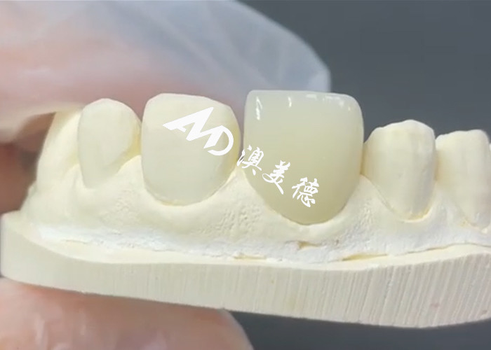 ผง EMAX ที่ทนทานและสวยงาม เป็นทางแก้ไขที่สมบูรณ์แบบสําหรับการซ่อมแซมโพรเซลน
