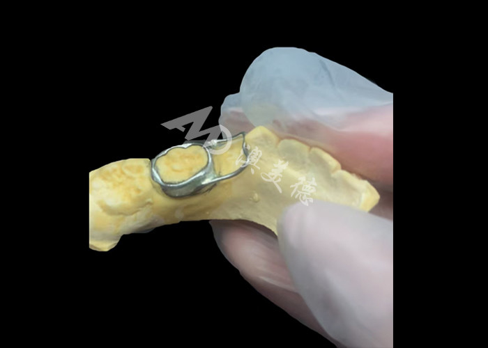 การรักษาพื้นที่ Orthodontic เป็นอุปกรณ์ที่คุ้มค่า ที่ปกป้องช่องว่างฟันของเด็กอย่างดี เพื่อให้ฟันพัฒนาอย่างถูกต้อง