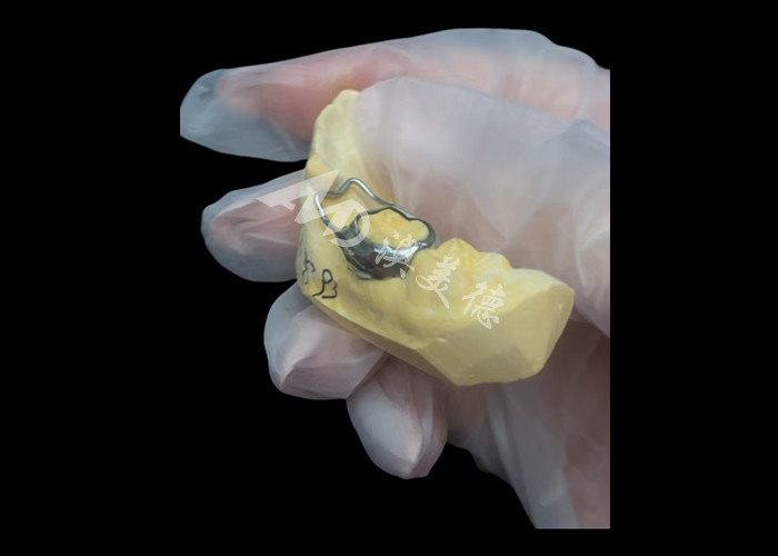 การรักษาพื้นที่ Orthodontic เป็นอุปกรณ์ที่คุ้มค่า ที่ปกป้องช่องว่างฟันของเด็กอย่างดี เพื่อให้ฟันพัฒนาอย่างถูกต้อง