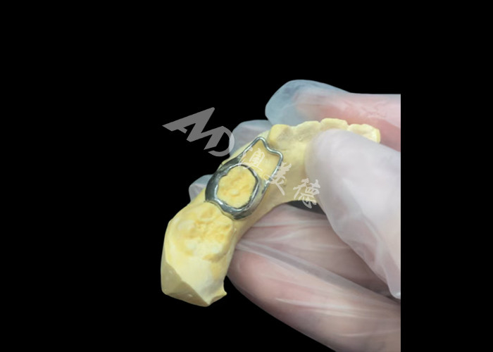 การรักษาพื้นที่ Orthodontic เป็นอุปกรณ์ที่คุ้มค่า ที่ปกป้องช่องว่างฟันของเด็กอย่างดี เพื่อให้ฟันพัฒนาอย่างถูกต้อง