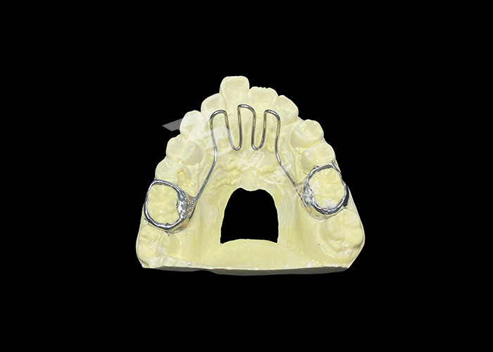 ช่องวางลิ้น อุปกรณ์ Orthodontic ที่ใช้ในการแก้ไขปัญหาของลิ้นและช่วยในการจัดฟันให้ตรงกันอย่างถูกต้อง
