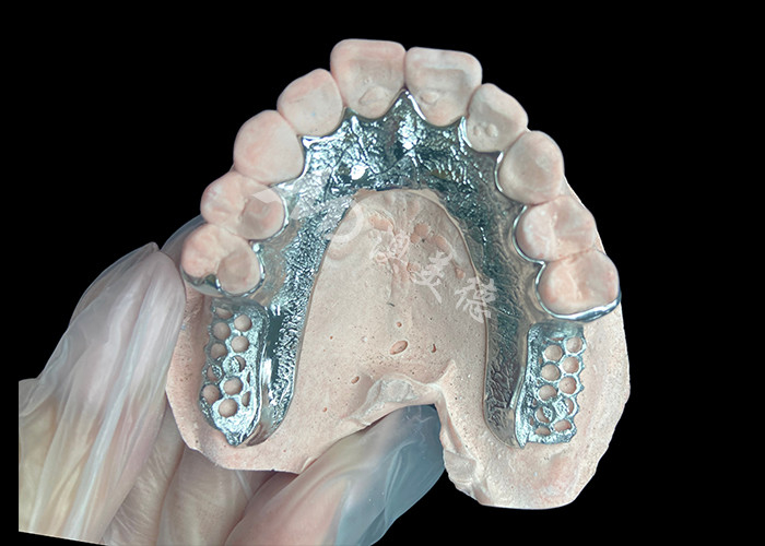 กําหนดการ Cast ส่วน denture โครงสร้างฟันเทียมฟันโดยไม่มีฟัน ตั้งสําหรับความมั่นคงและการทํางาน