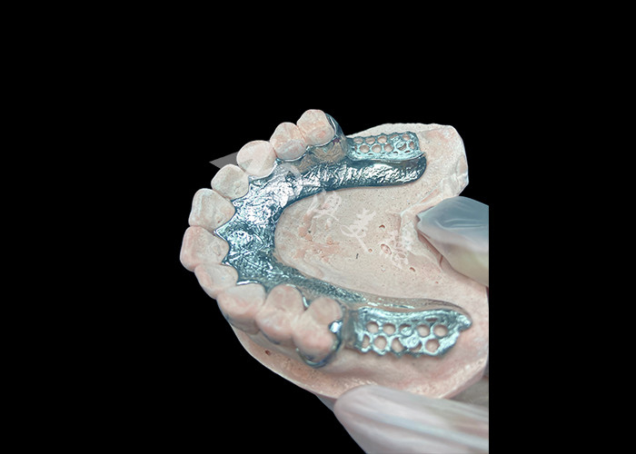 กําหนดการ Cast ส่วน denture โครงสร้างฟันเทียมฟันโดยไม่มีฟัน ตั้งสําหรับความมั่นคงและการทํางาน