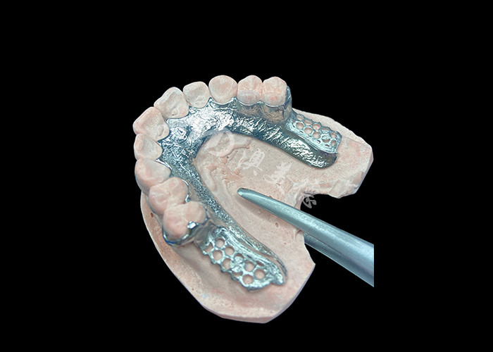 กําหนดการ Cast ส่วน denture โครงสร้างฟันเทียมฟันโดยไม่มีฟัน ตั้งสําหรับความมั่นคงและการทํางาน