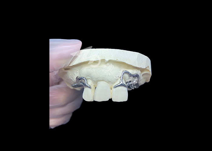 สะดวกสบาย Custom Cast Partial Denture โครงสร้างที่มั่นคงและดูธรรมชาติสําหรับผลการผลิตอย่างรวดเร็ว